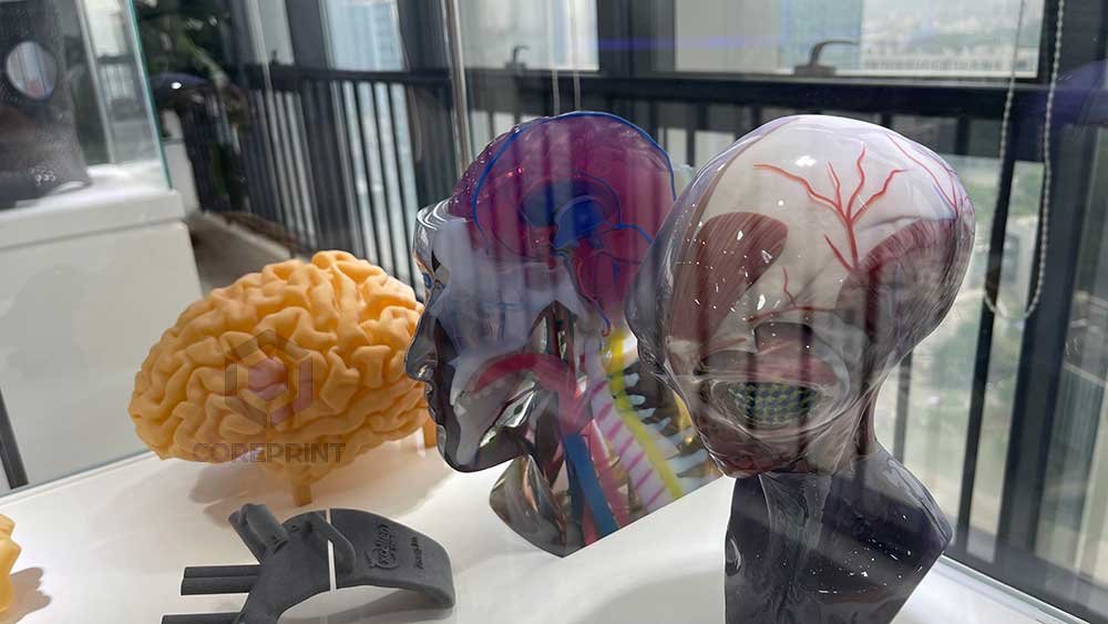 3D printing of medical models